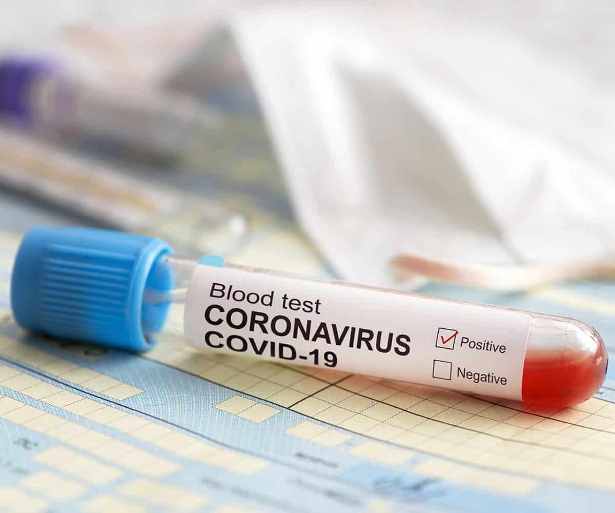 Coronavirus update: Cases spike to 3 158, two more deaths recorded