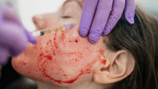 The 'Vagacial' And Three Other 2022 Beauty Treatments