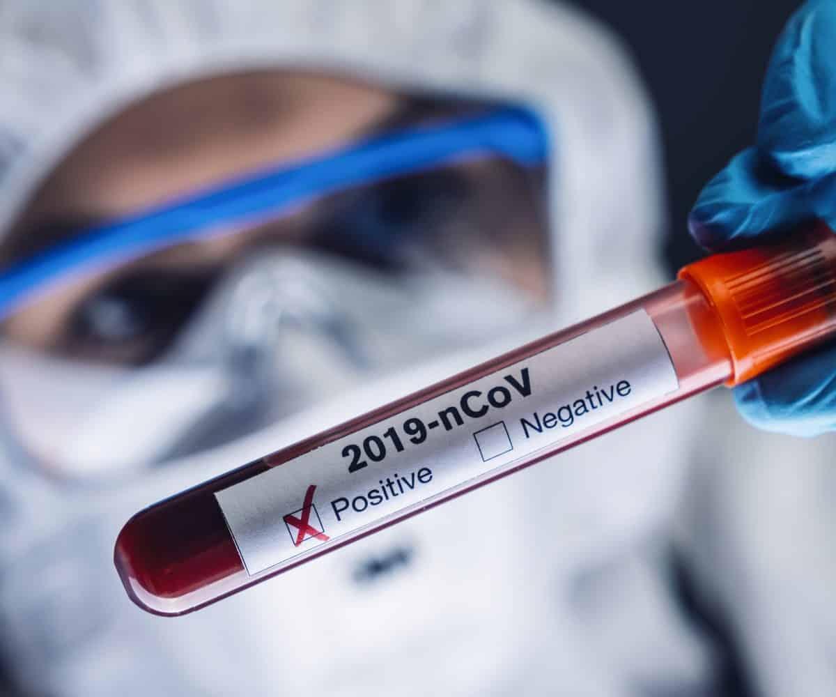 True extent of coronavirus in Eastern Cape unknown, says DA